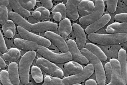 This electron microscope image provided by the Centers for Disease Control and Prevention shows Vibrio vulnificus bacteria in 2005. (Janice Haney Carr/CDC via AP)